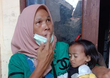 Derita Sakit Menahun, “Salsabila Nabila Putri” Luput Dari Perhatian Pemerintah