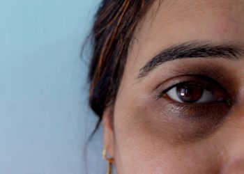 Singkat dan Mudah! Yuk, Atasi Mata Panda yang Bikin Turun PD