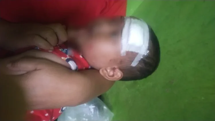 balita korban pohon tumbang